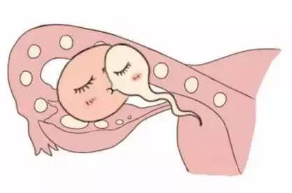 关于借卵代生包女孩代生包成功